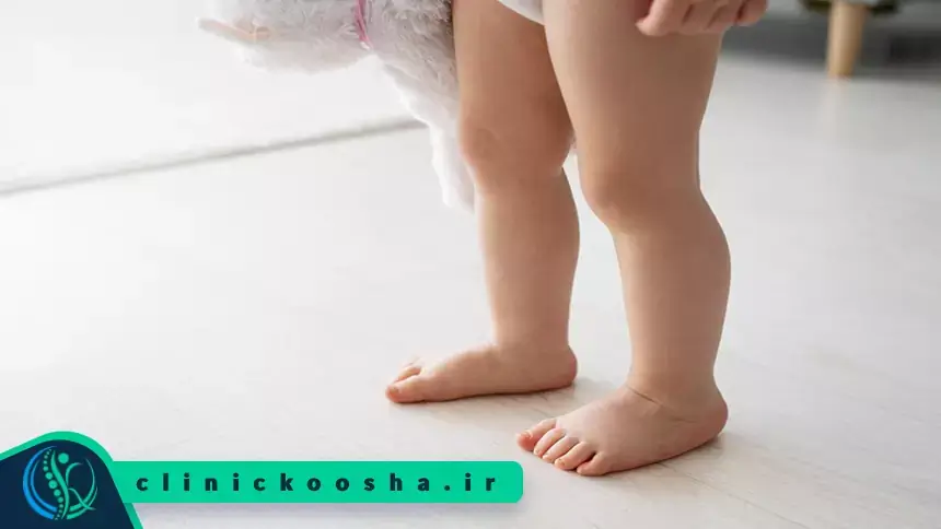 درمان صافی کف پای کودکان